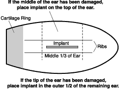 Proper implant placement